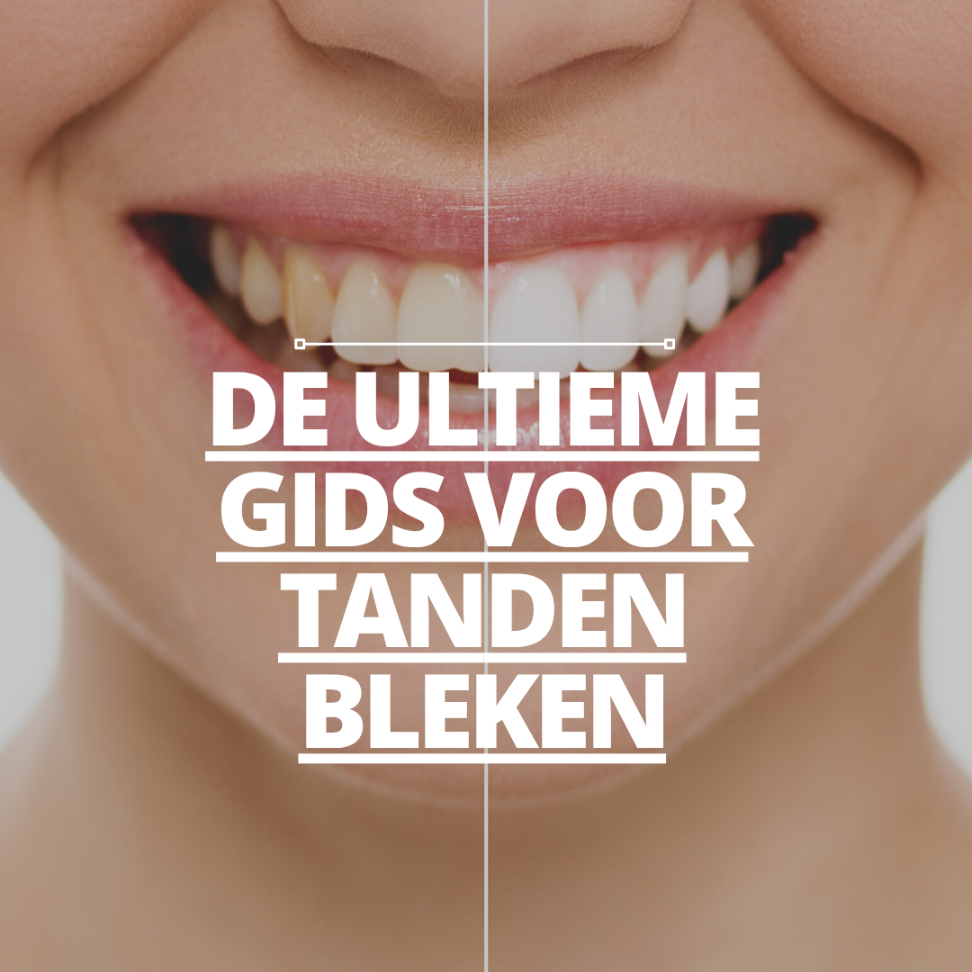 De Ultieme Gids voor Tanden Bleken: Thuis versus Tandartspraktijk