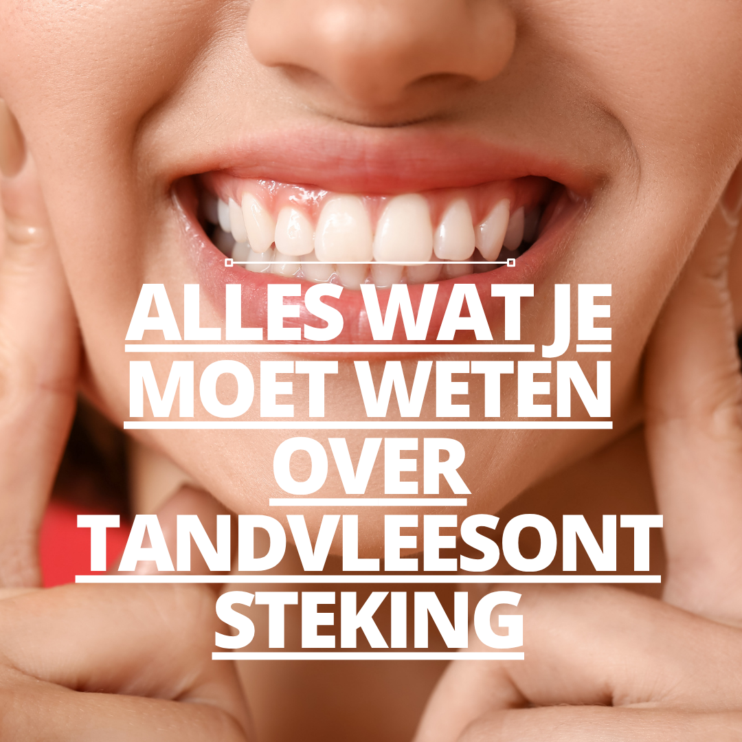 Alles wat je moet weten over tandvleesontsteking