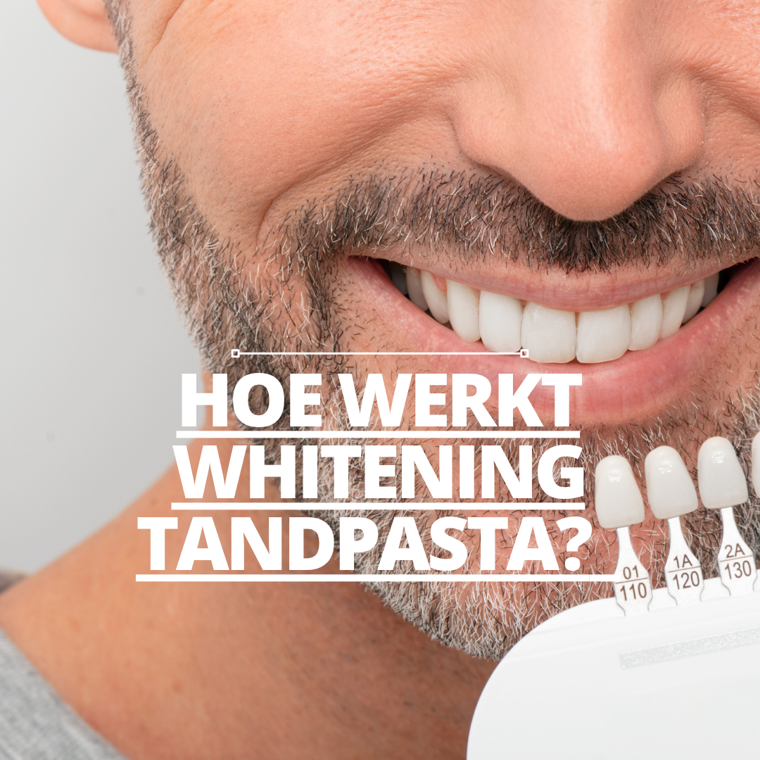 Hoe werkt whitening tandpasta?