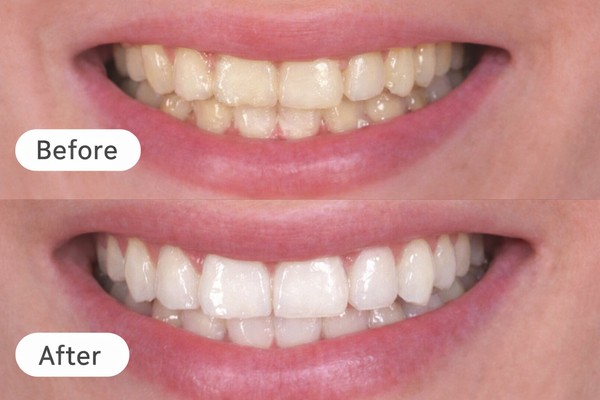 Ideaal voor koffiedrinkers!