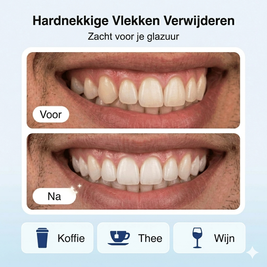 Crest 3D Whitening Strips Professional Effect Luxe