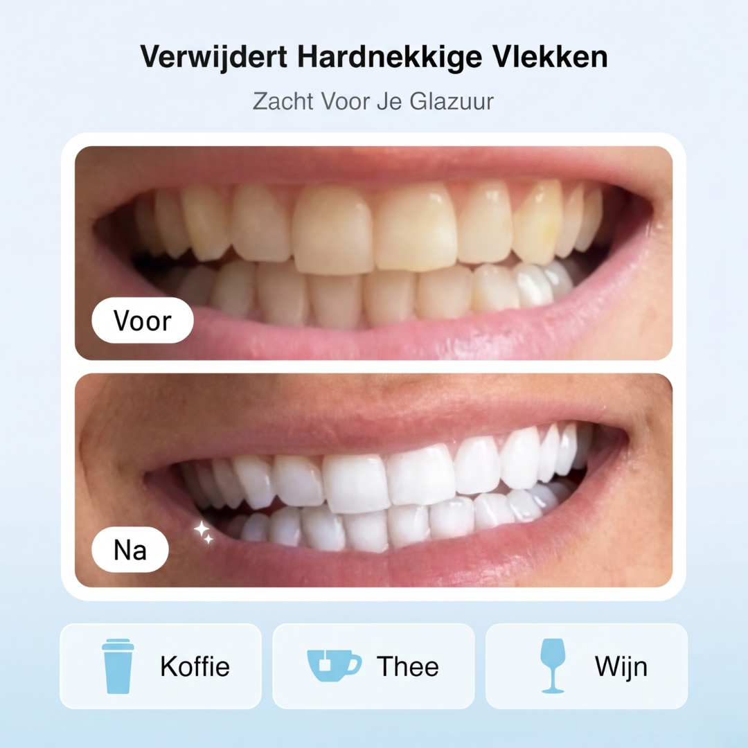 My Whitestrips PAP+ | Whitening & Mondverzorging