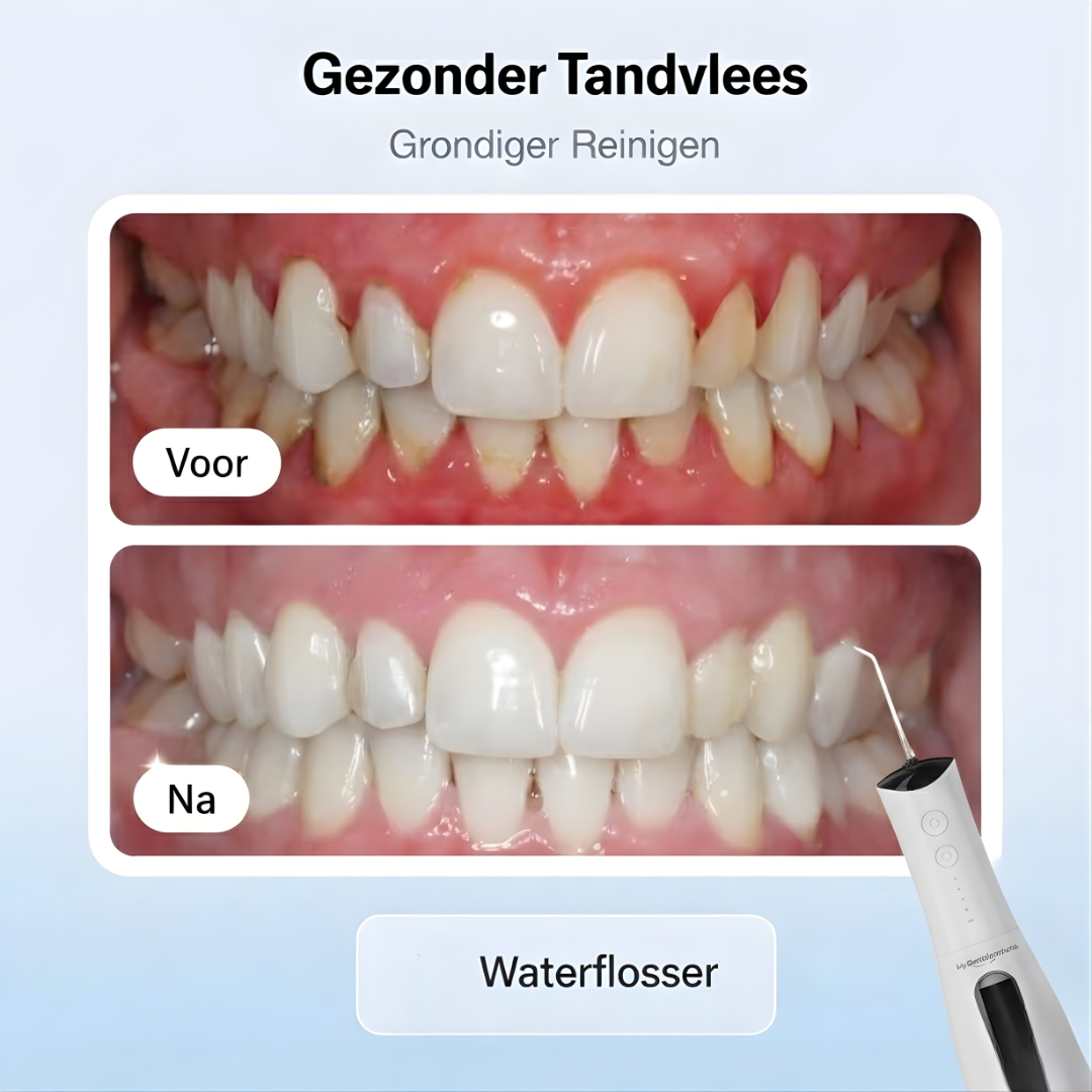 My Waterflosser | Sterker en gezond tandvlees