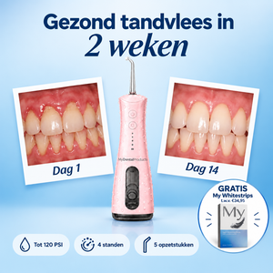 My Waterflosser | Sterker en gezond tandvlees