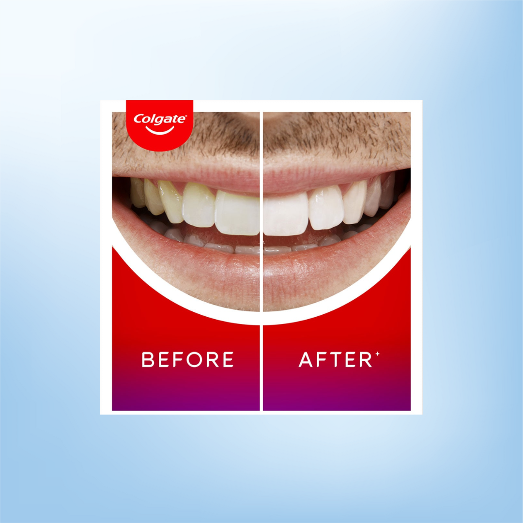Colgate Max White Overnight Whitening Pen - 75 ML