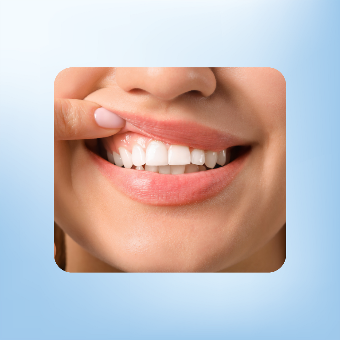 6x Vitis Gezond Tandvlees Mondspoelmiddel (500 ml)