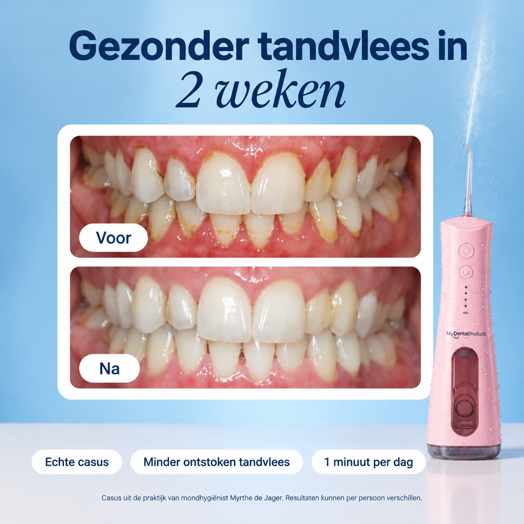 My Waterflosser | Sterker en gezond tandvlees
