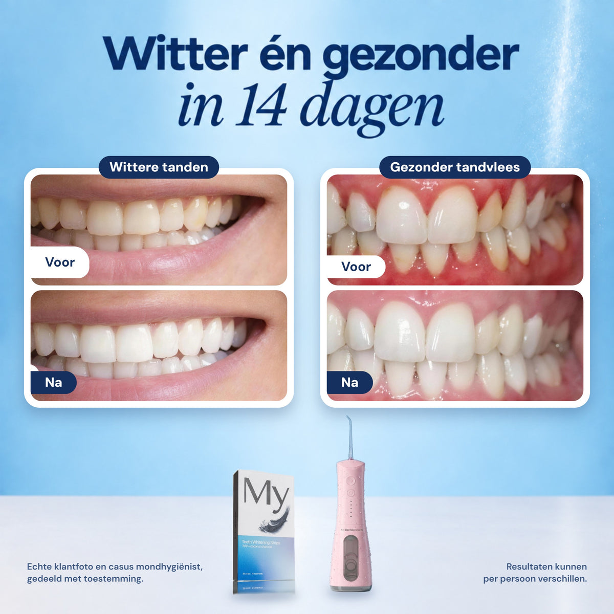 Waterflosser + Whitestrips — Complete Whitening Bundel