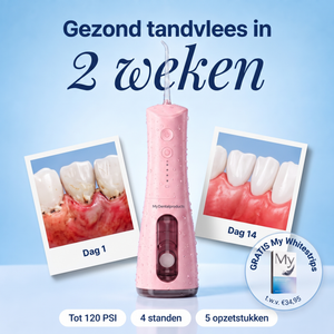 My Waterflosser | Sterker en gezond tandvlees