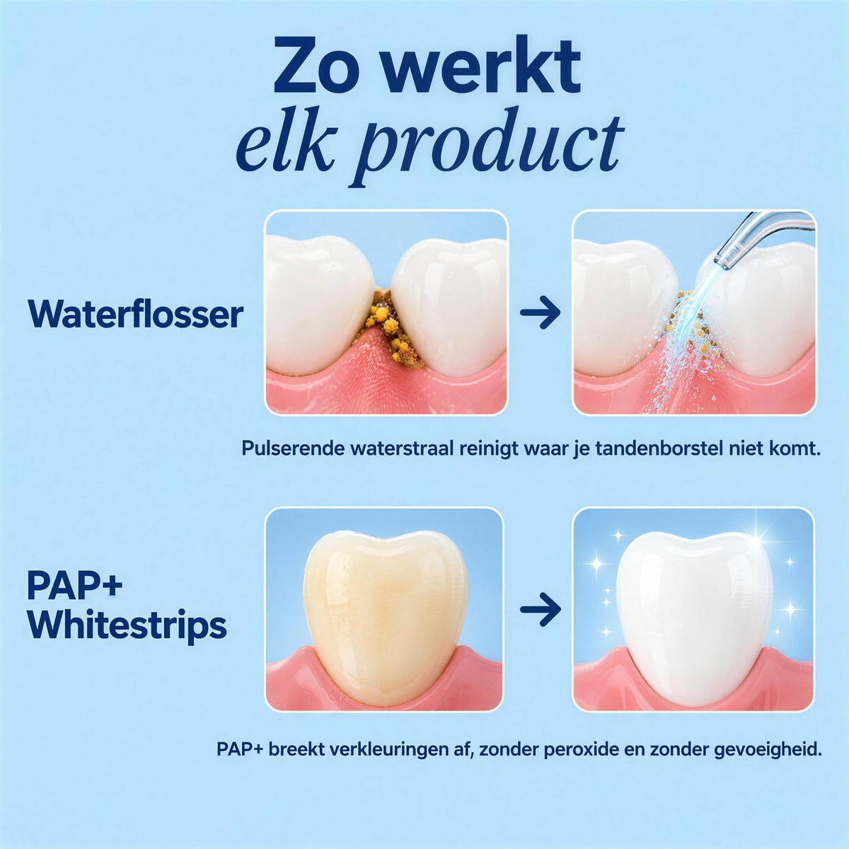 Waterflosser + Whitestrips — Complete Whitening Bundel