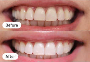 Snel resultaat gezien