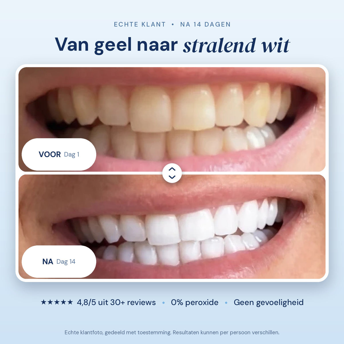My Whitestrips PAP+